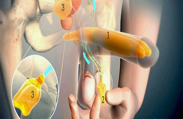 Lipofilling Operatioun