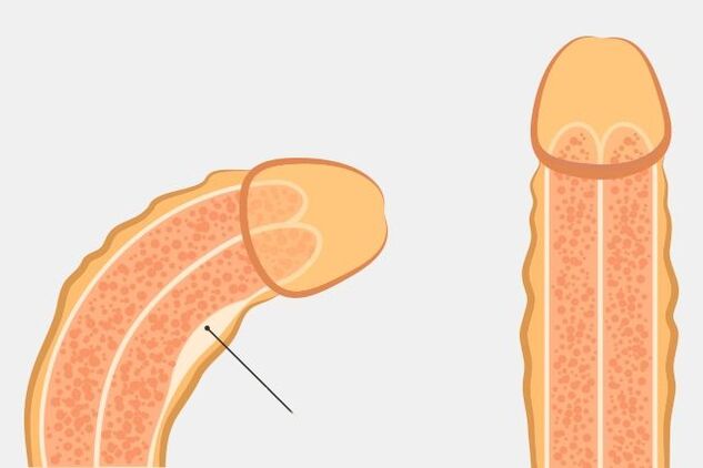 effektiv Manéier fir de Penis ze riichten